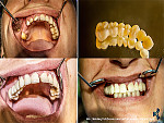 dental samples
